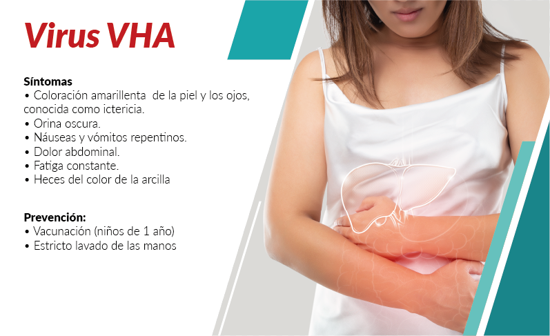 Hepatitis A